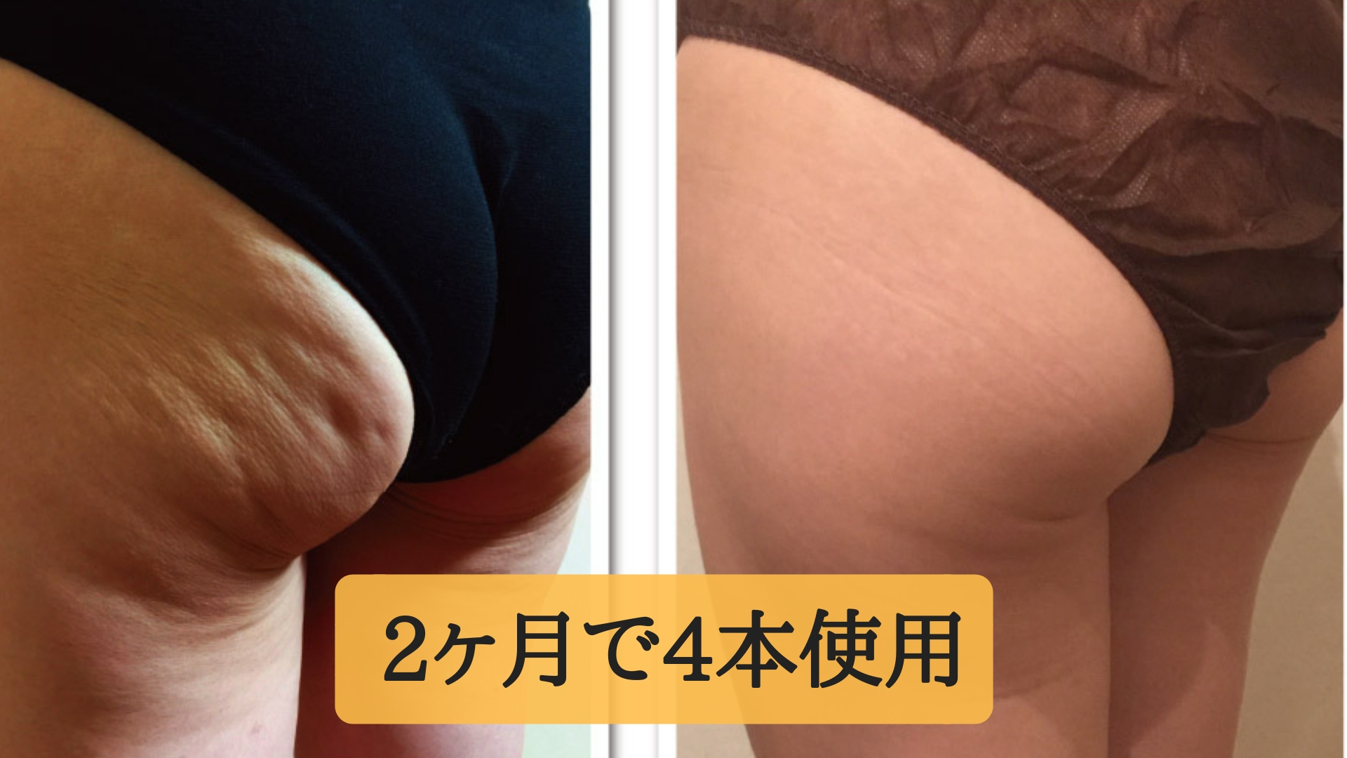 ヴィクトリアボディスリミング