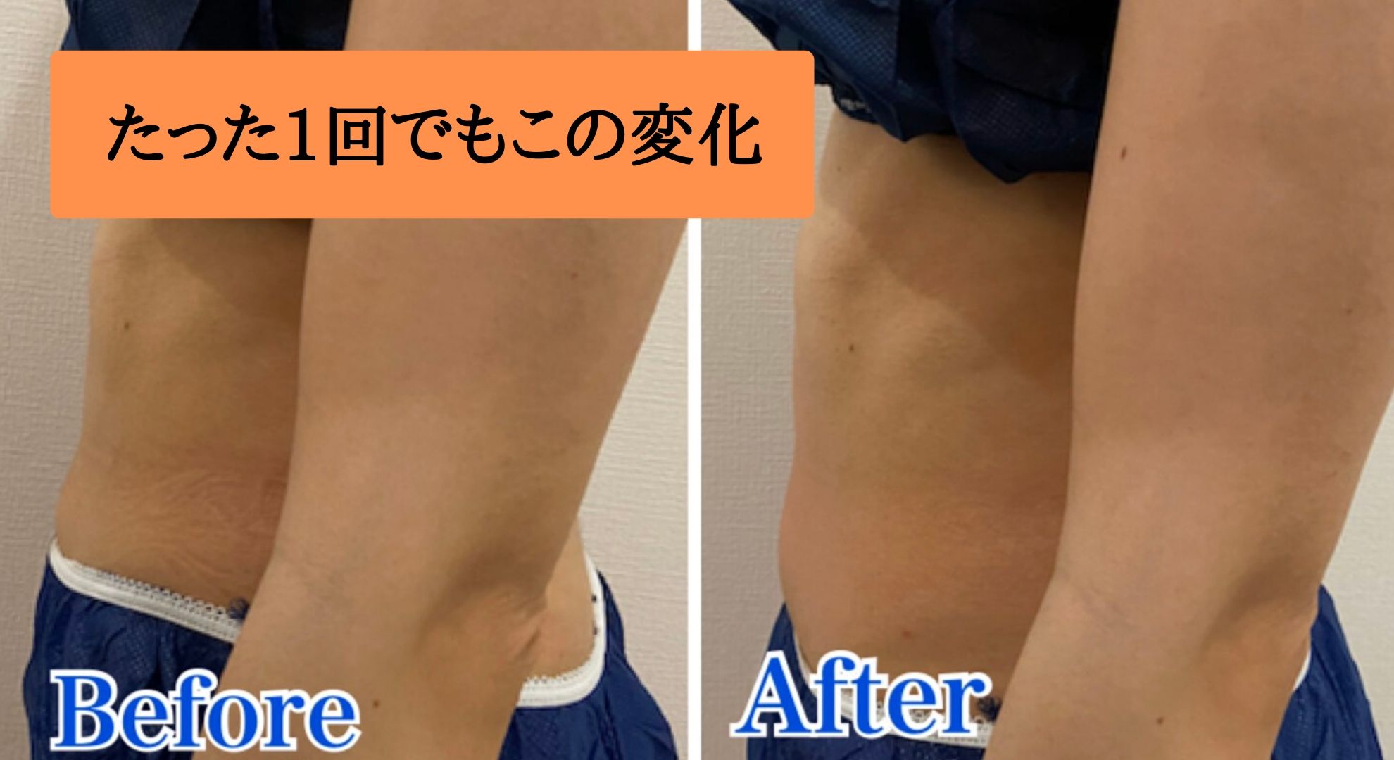 ボディメイクデトックスケア