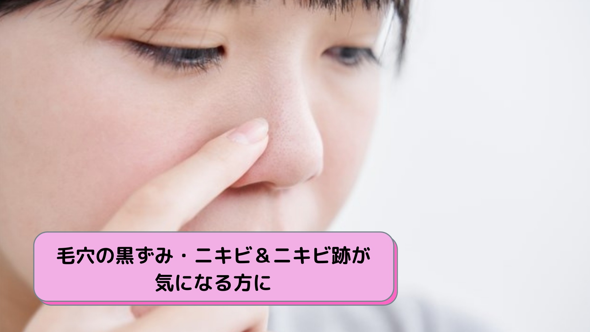 毛穴の黒ずみ・ニキビ＆ニキビ跡が気になる方に