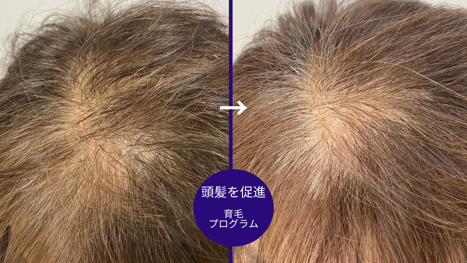 Salon de WISHに初めて育毛でご来店される方に