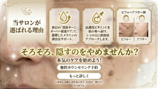 「もう隠さない」と決めた日から、あなたの肌は再生し始める。丸亀で叶える、シミにさよならする根本ケア