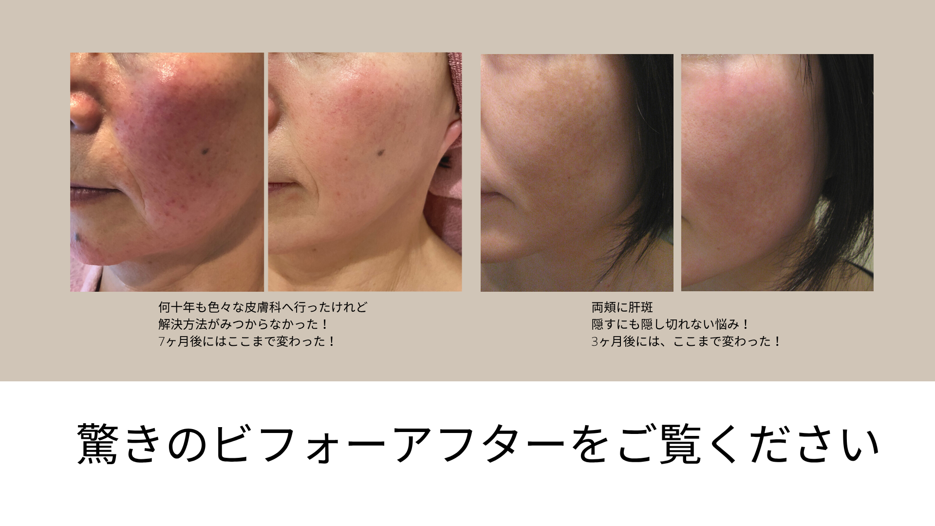 驚きのビフォーアフター