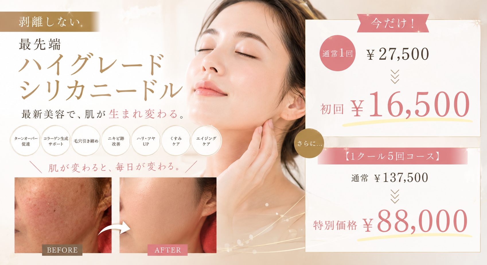 剥離しない最先端ハイグレード シリカニードル